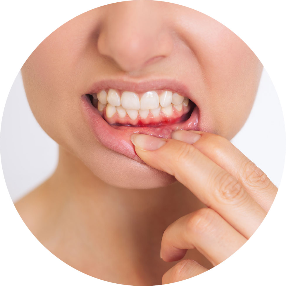 デンタルフロスは虫歯や歯周病ケアの必需品です